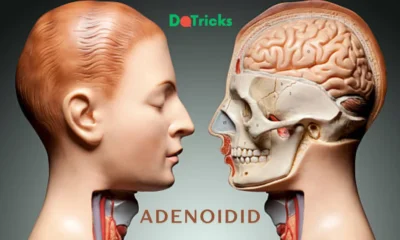 adenoidid