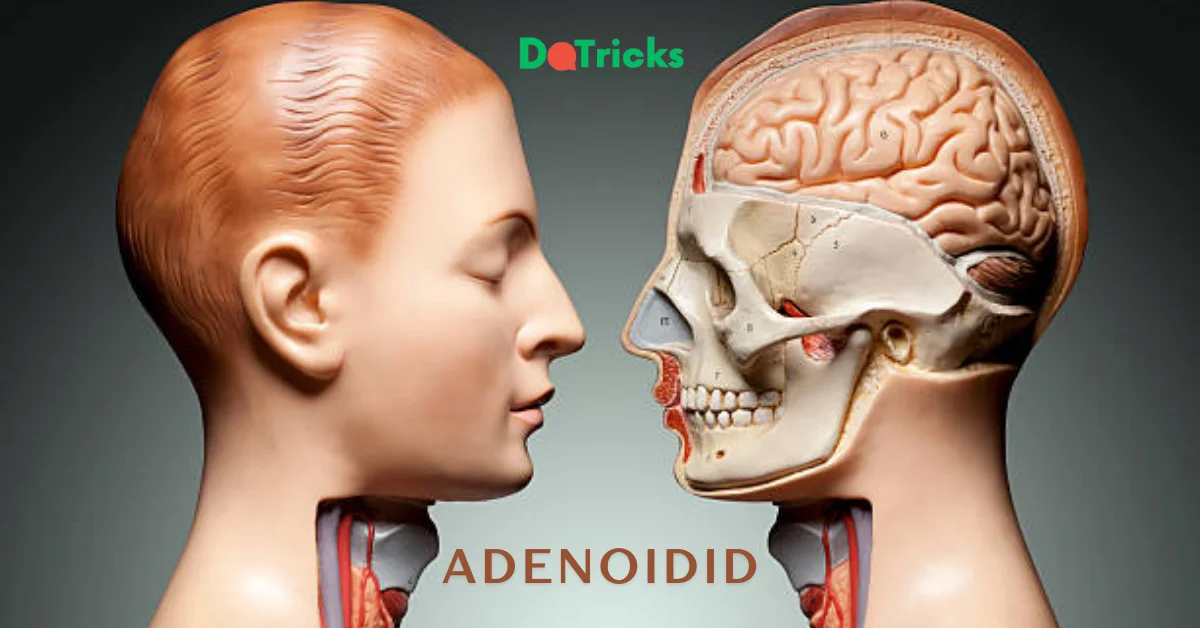 adenoidid